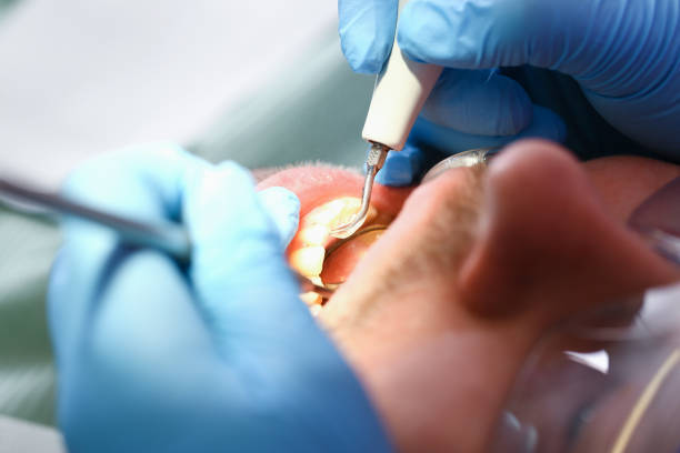 Best Emergency Treatment for Dental Infections or Abscesses in Mount Olive, IL